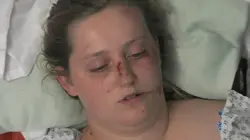 24 Uur In De ER The unforeseen