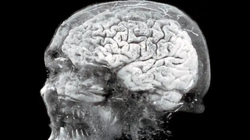 Amnésie : Où se cache la mémoire ?