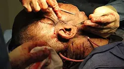 Visuel de Anomalies médicales