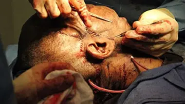 Anomalies médicales E01 Mon tout nouveau visage