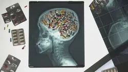 Antidouleurs, potion ou poison ?