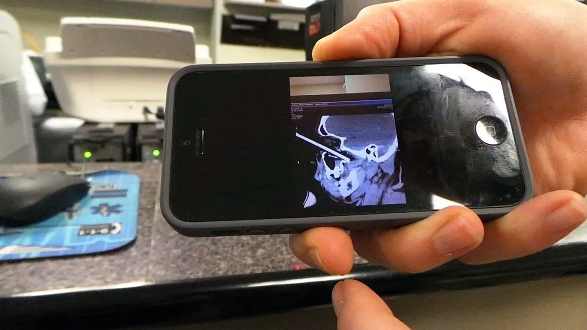 Au secours : enlevez-moi ça ! Un escarpin dans l'œil