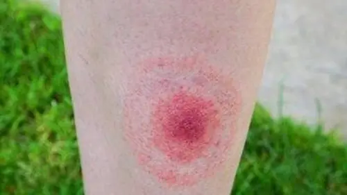 Axel au pays des malades imaginaires