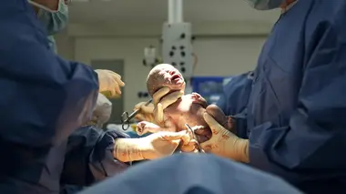 Baby boom Naissances sous haute surveillance