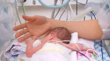 Baby boom Nés prématurés