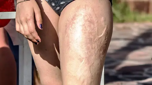 Body Bizarre un accident qui change tout