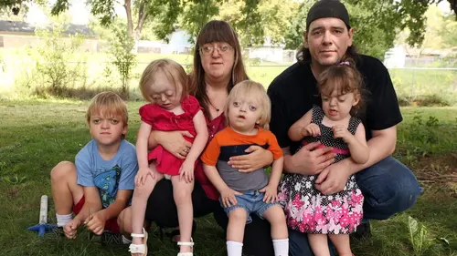 Casting Body Bizarre Le garçon sans mâchoire