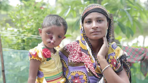 Body Bizarre Siamoises par la tête