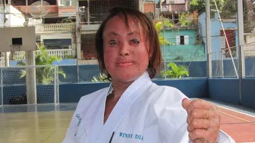 Body Bizarre Le coeur à l'extérieur