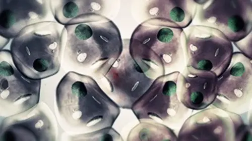 Cancer : la piste oubliée