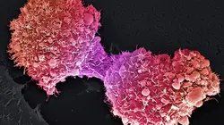 Cancers : quelles thérapies pour demain ?