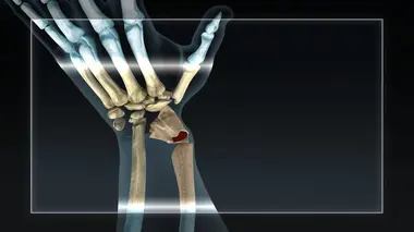 Le champion californien