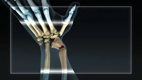 Chasse à l'homme Le champion californien