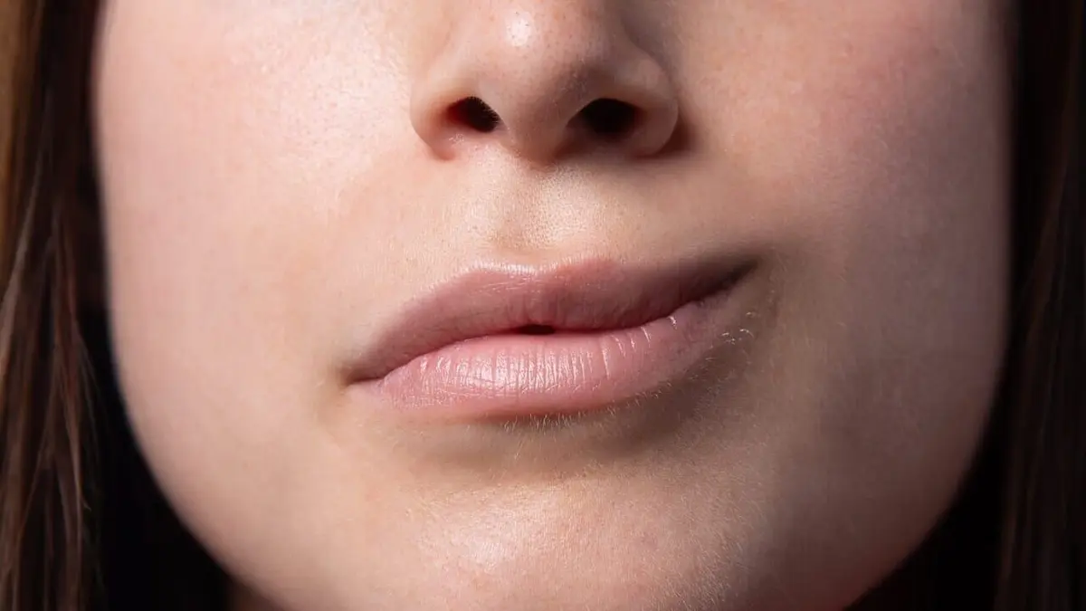 Chirurgie du visage : un nouvel espoir Je ne peux pas sourire