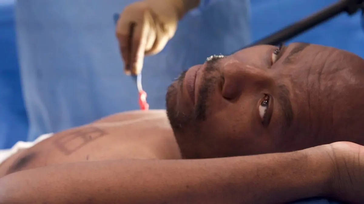 Chirurgie éveillée Derrick montre son sein