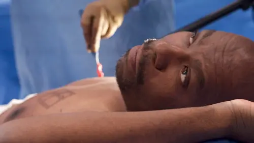 Chirurgie éveillée Derrick montre son sein