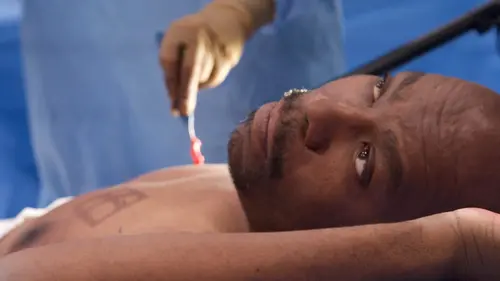 Chirurgie éveillée