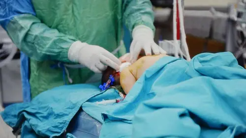 Chirurgie pour enfants : ils redonnent le sourire aux familles