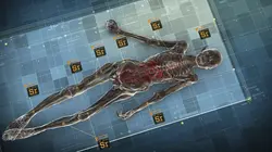 Cold cases de l'Antiquité