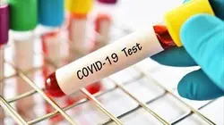 COVID 19 : un été sous surveillance