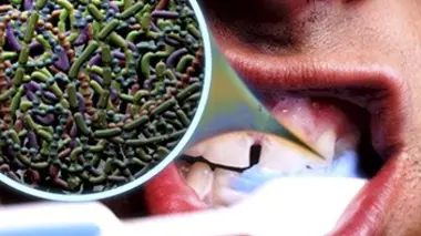 Créatures intérieures
