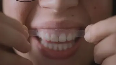 Des dents blanches... au rire jaune !