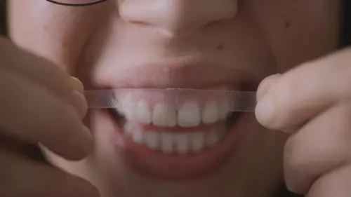 Photos de Des dents blanches... au rire jaune !