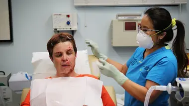 Dr Pimple Popper Naevus ni connu