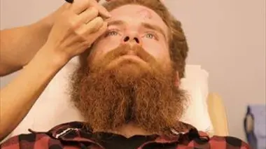 Dr Pimple Popper S01E02 Furieux furoncles