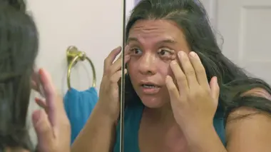 Dr Pimple Popper Un lipome est né