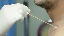 Enquête de santé Abus d'antibiotiques : une catastrophe annoncée