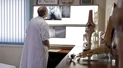 Enquête de santé Ostéoporose : vraie menace ou fausse maladie ?