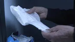 Etat de santé Prostate : L'ablation en question