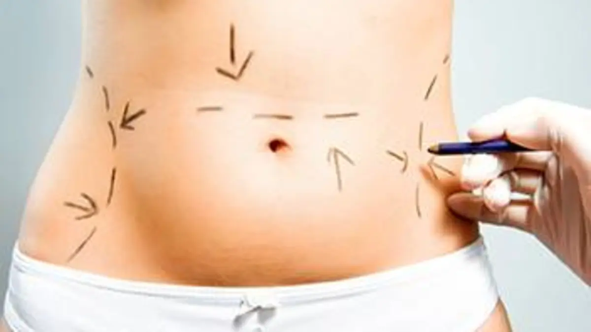 Ils ont choisi la chirurgie esthétique E01