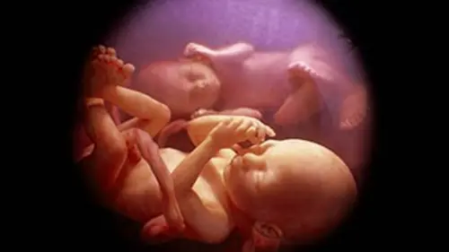 In utero Jumeaux et plus encore