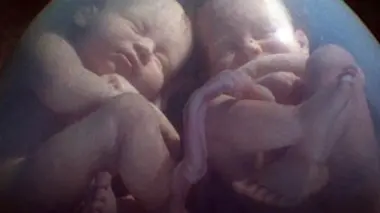 Les vrais faux jumeaux