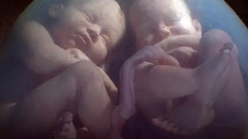 In utero Les vrais faux jumeaux