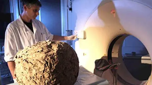 Insectmania E02 Insectes médecins