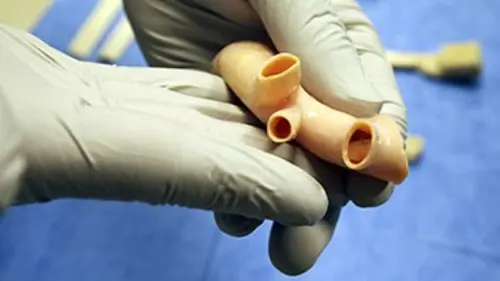 Inside : le trafic d'organes