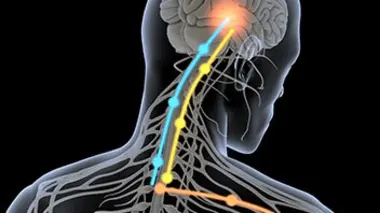 L'effet placebo