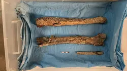 L'histoire au scalpel