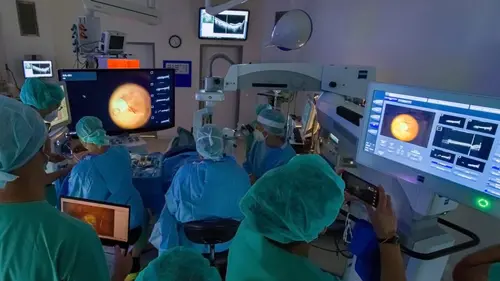 L'oeil et la vision : focus sur les avancées scientifiques