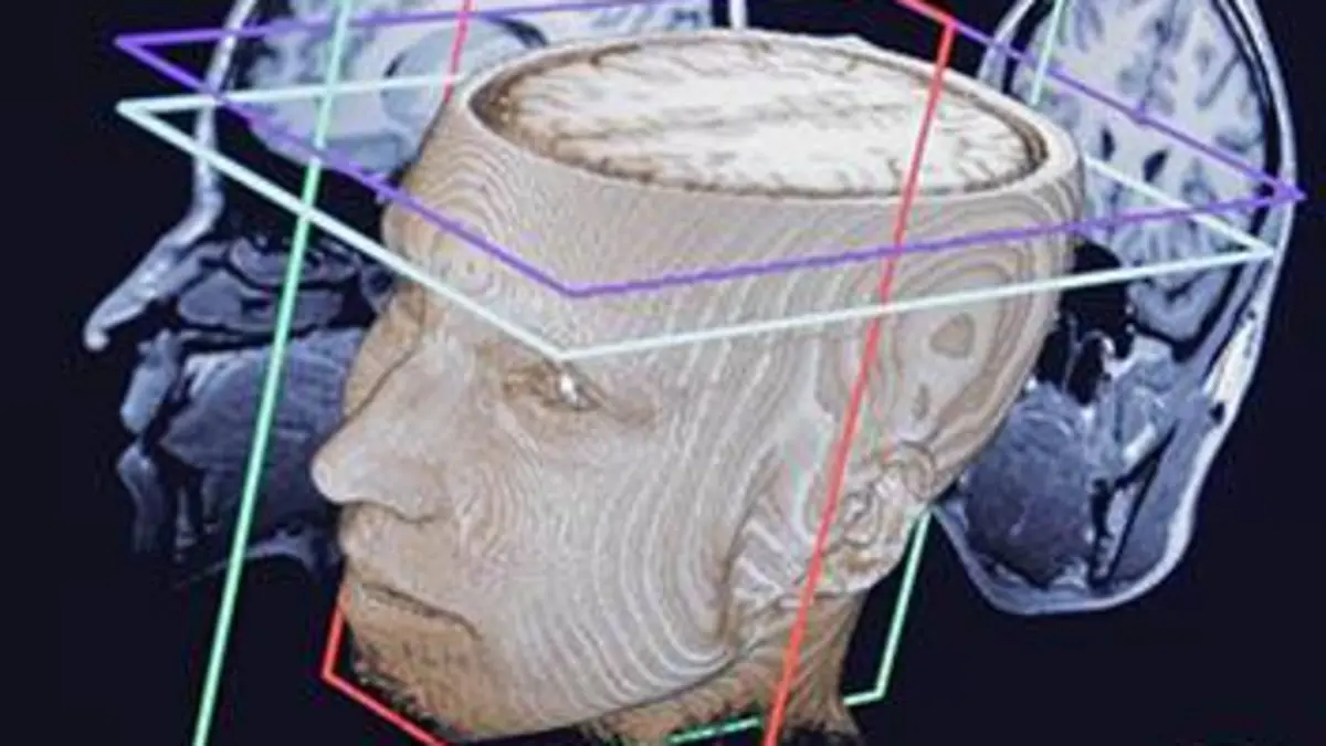 La fabrique du cerveau