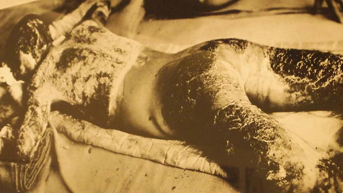 La face cachée de Hiroshima