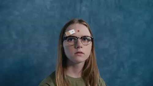 La méthode Flore S05E05 Acné