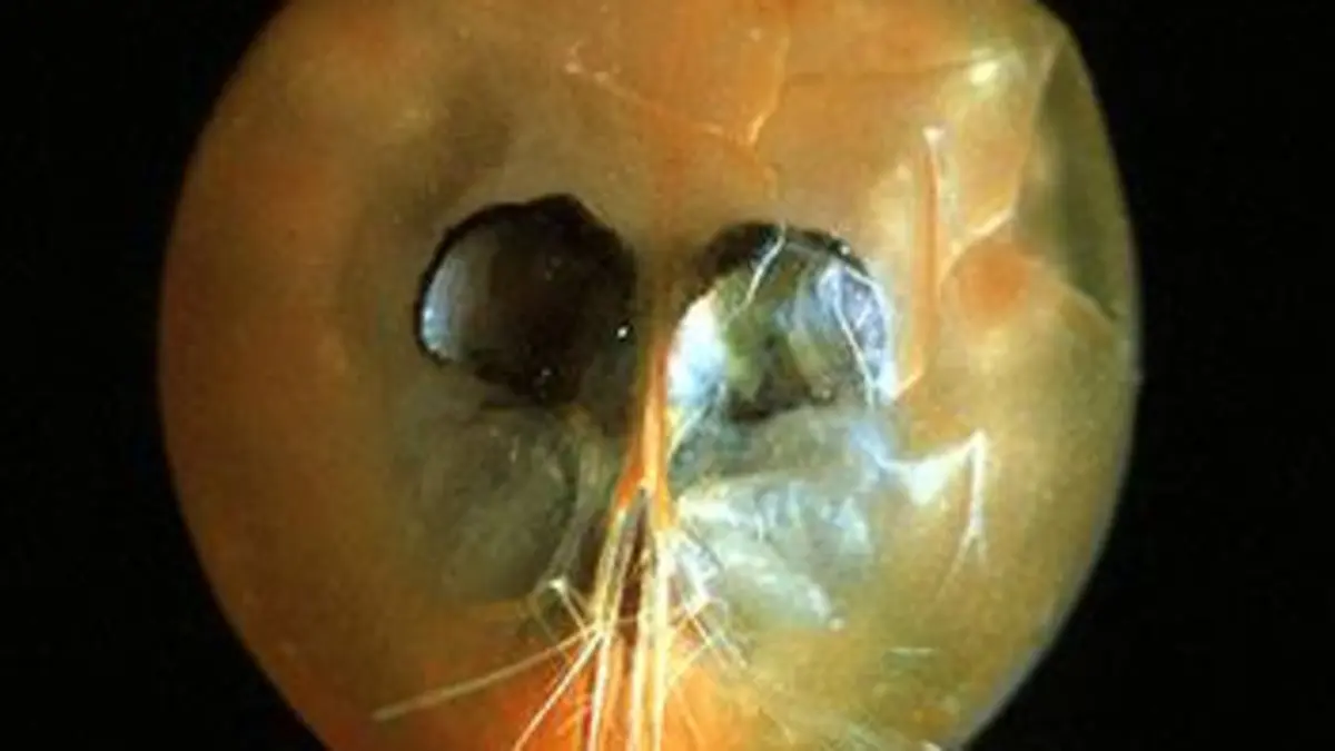 Planète bleue E02 Les abysses