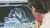 La vie entre parenthèses, 4 femmes face au cancer du sein