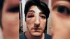 La violence antiqueer