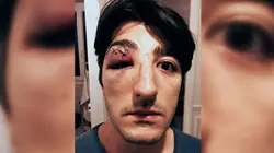 La violence antiqueer