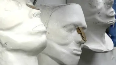 Les chirurgiens de l'espoir